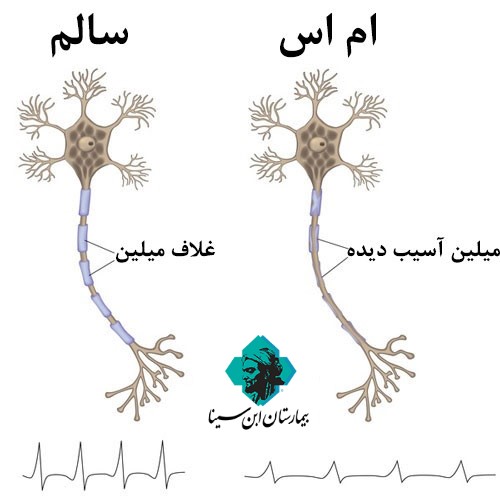 EbnesinahospitalMS